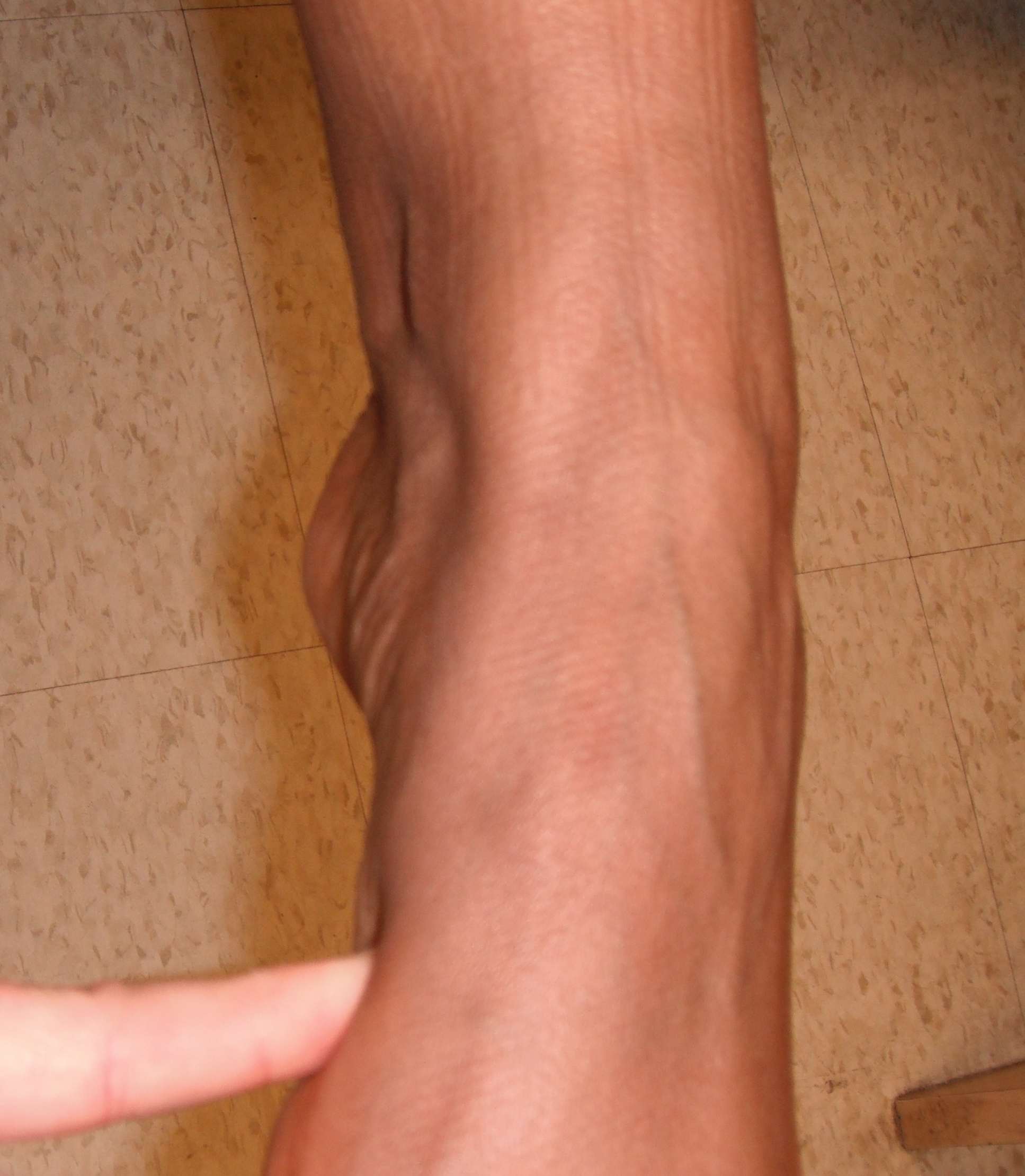 Foot Exam Tibialis Posterior